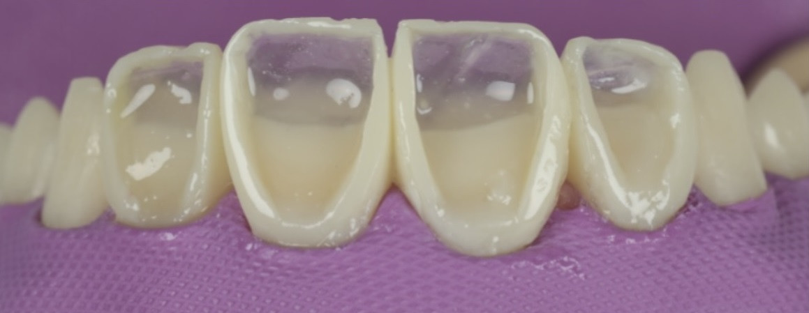 Dental course promo
